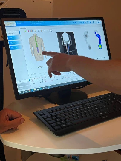 Реабілітація