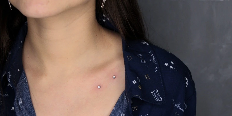 микродермал