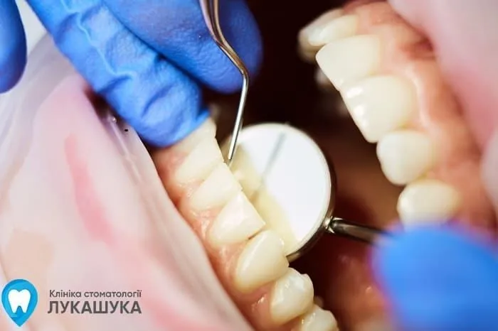 Джерело: lukashuk.com.ua