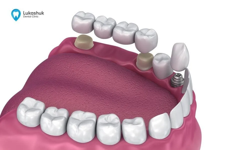 Джерело: lukashuk.com.ua