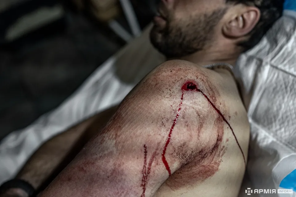 робота стабілізаційного пункту біля Авдіївки